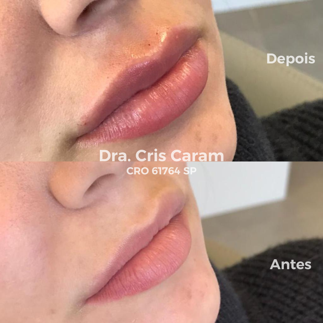 Artes webinar Feed (10)